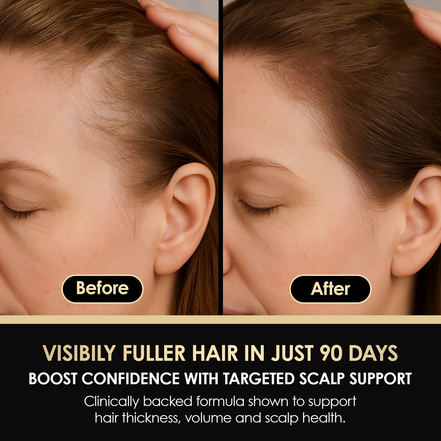 ThickTails Root Stimulating Leave-In Serum | Buy 2, Get 1 Free