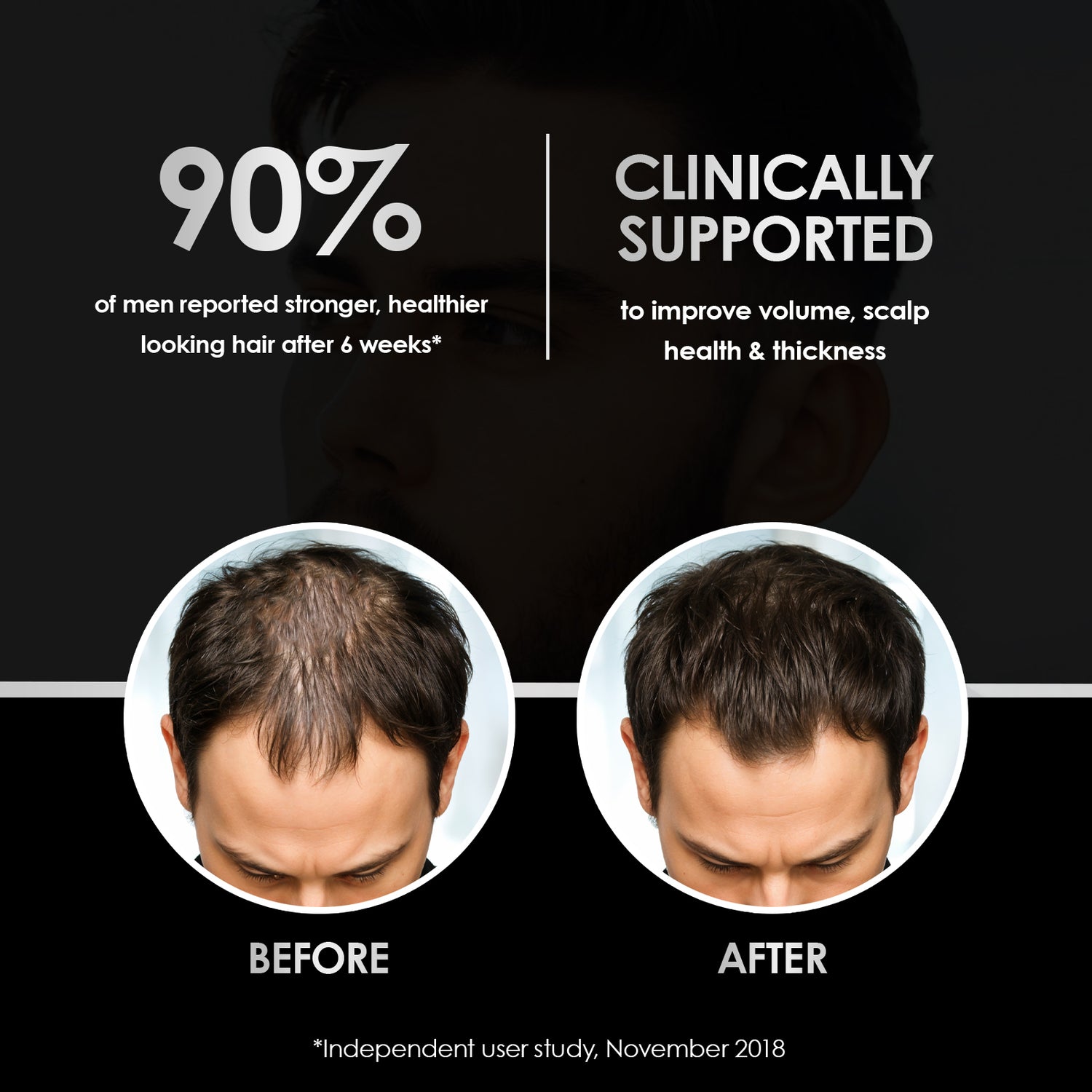 ThickTails Men’s Stimulating Hair Growth Shampoo & Conditioner | Dual Pack