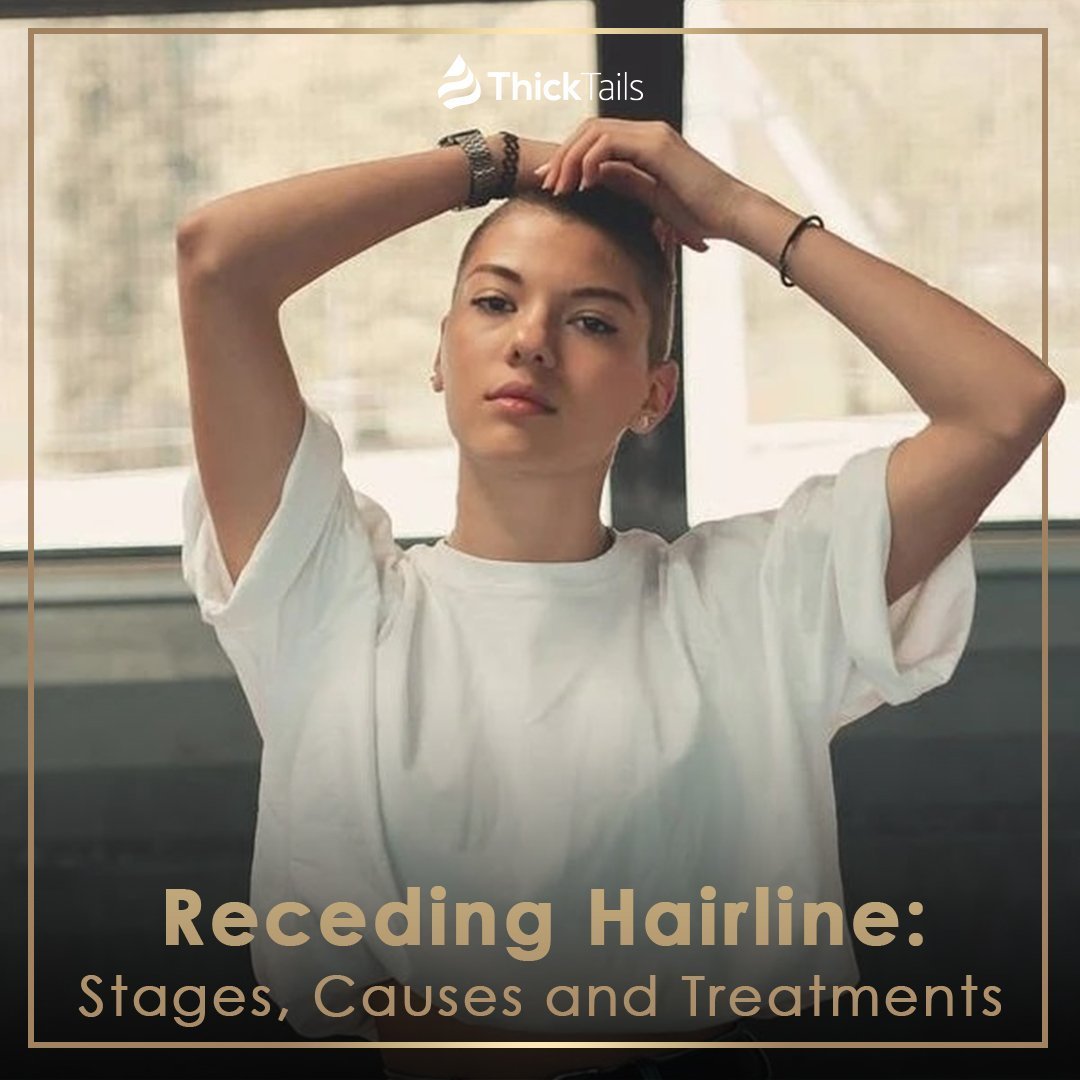 Receding Hairline: Stages, Causes and Treatments | ThickTails