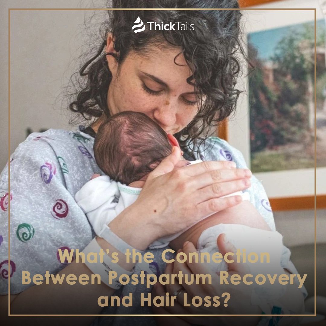What’s the Connection Between Postpartum Recovery and Hair Loss? | ThickTails