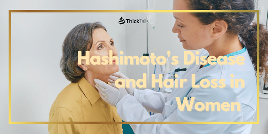 Hashimoto's Disease and Hair Loss