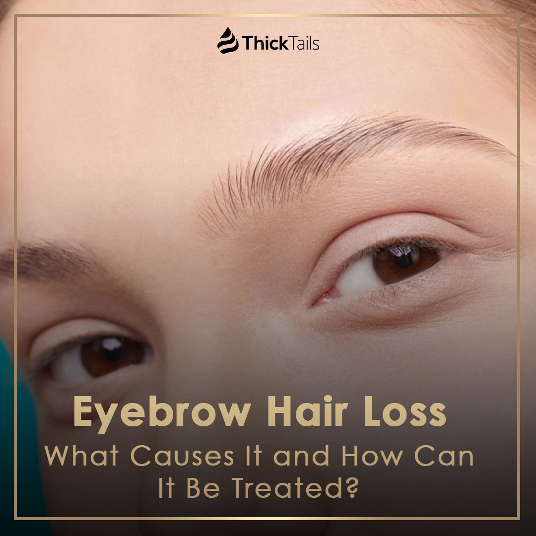 Eyebrow Hair Loss: What Causes It and How Can It Be Treated? | ThickTails
