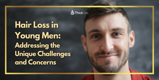 hair loss in young men