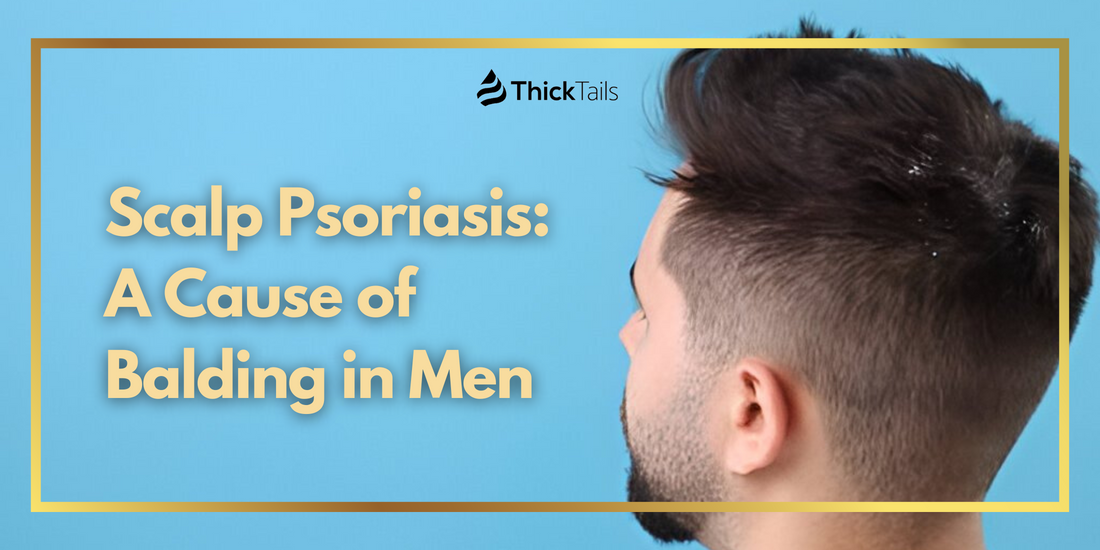 Scalp Psoriasis and Hair Loss