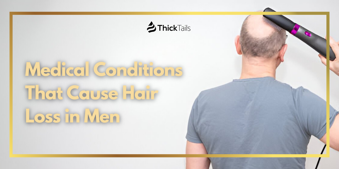 Medical Conditions That Cause Hair Loss