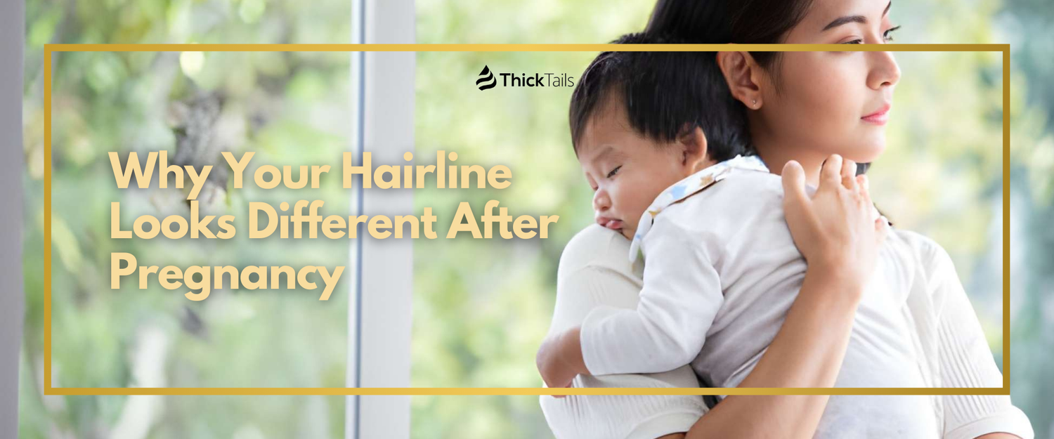 Why Your Hairline Looks Different After Pregnancy
