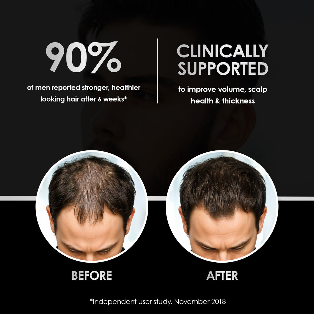 ThickTails Men’s Stimulating Hair Growth Shampoo & Conditioner | Dual Pack