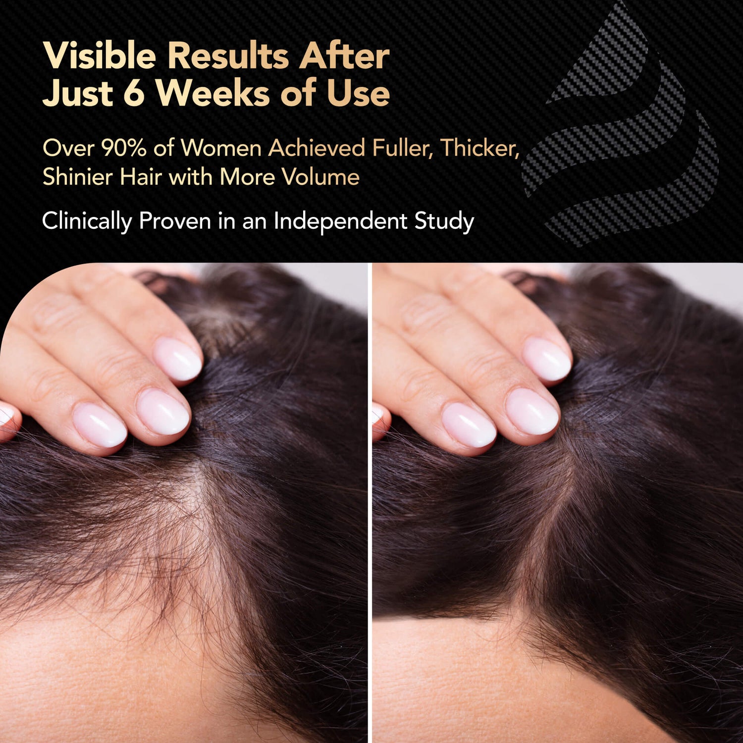 ThickTails Hair Growth &amp; Strengthening Vitamins | 3 Months Supply | Buy 2, Get 1 Free
